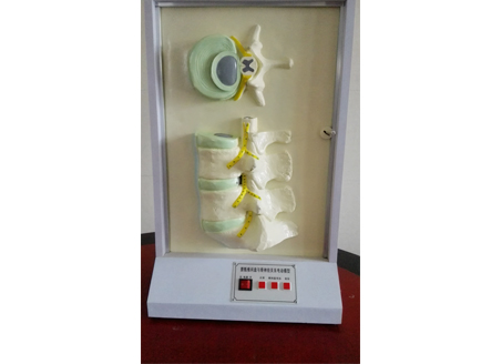 ZM8035 腰骶椎間盤和脊神經(jīng)電動(dòng)模型